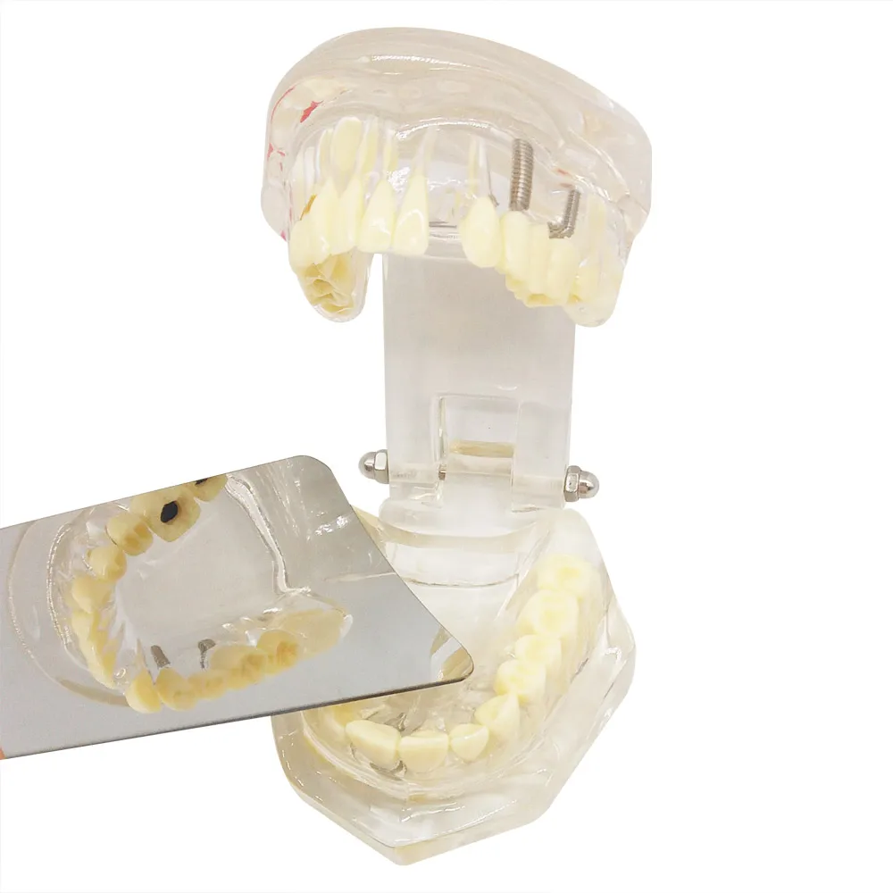 Zubné Intraoral Nehrdzavejúcej Ocele Fotografické Zrkadlá pre Ortodontické 4pcs/veľa